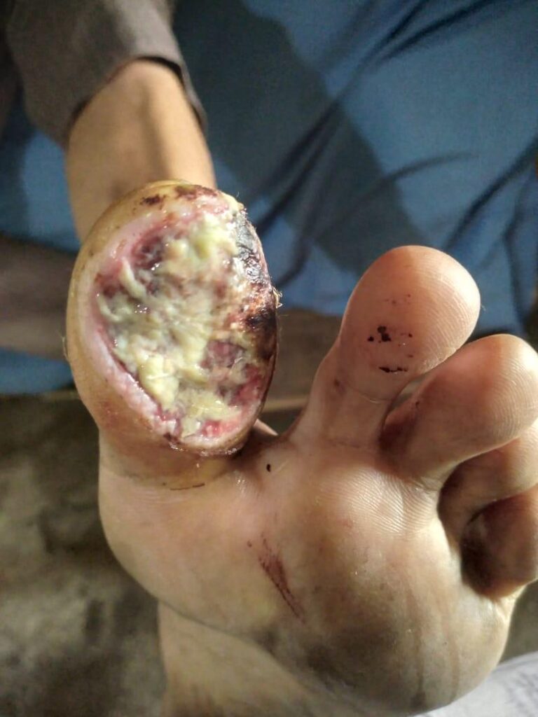 Pastor who suffered from a serious leg infection.
